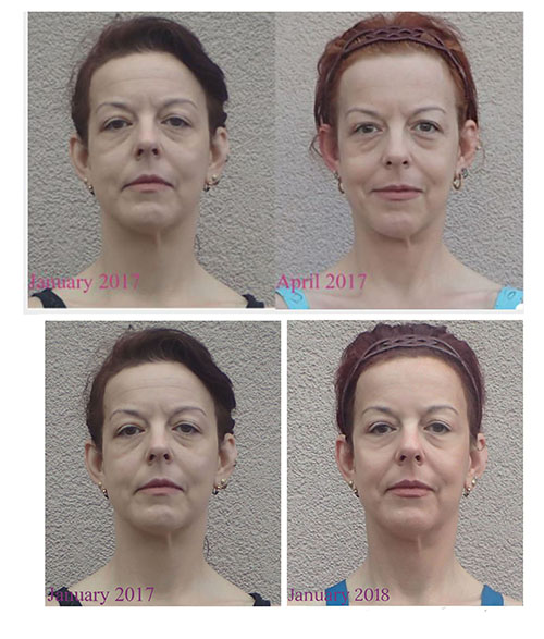 Face Yoga testimonial photo